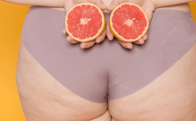 rectocèle solution Emy