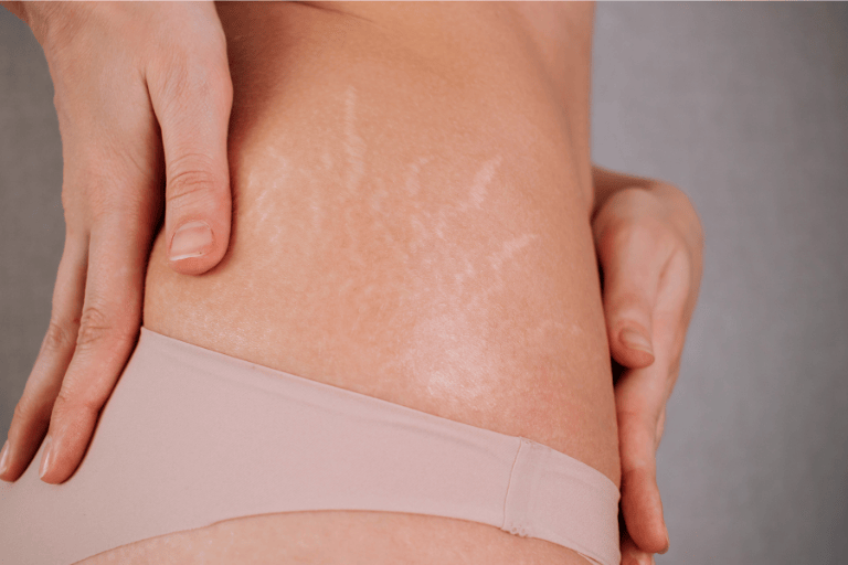 Anatomie du fascia pelvien et des muscles du périnée féminin